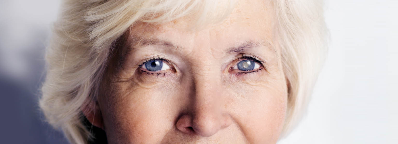 Cataract Surgery in Burleson